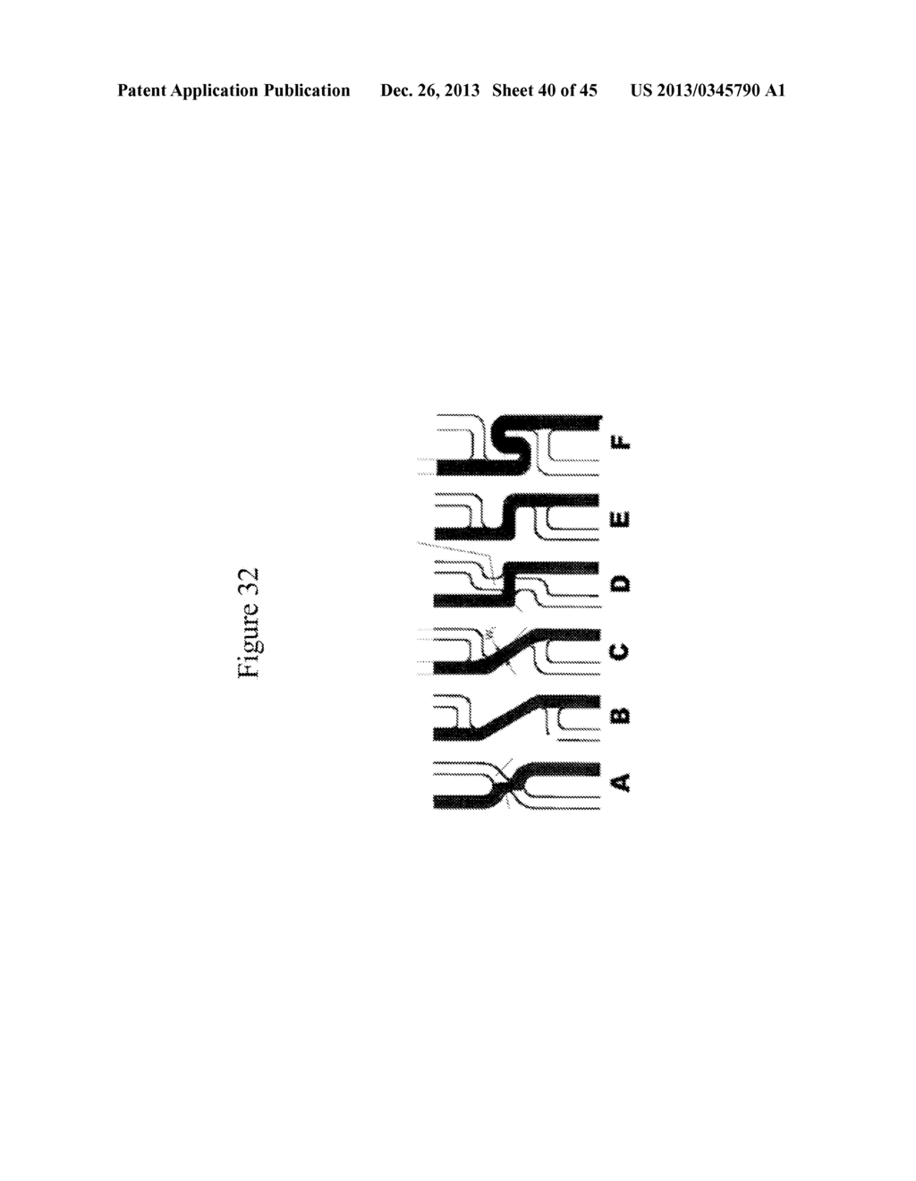 MEDICAL DEVICE FOR IMPLANTATION INTO LUMINAL STRUCTURES - diagram, schematic, and image 41