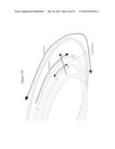 MEDICAL DEVICE FOR IMPLANTATION INTO LUMINAL STRUCTURES diagram and image