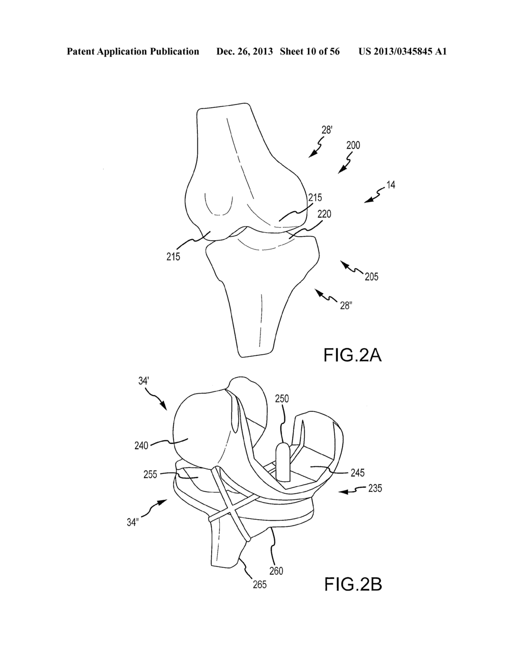 ARTHROPLASTY SYSTEM AND RELATED METHODS - diagram, schematic, and image 11