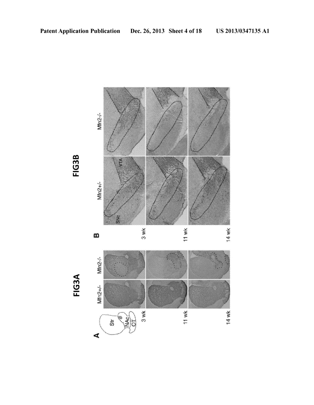 ANIMAL MODEL FOR PARKINSON'S DISEASE - diagram, schematic, and image 05