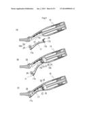 LEVER DEVICE diagram and image