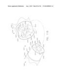 DIFFERENTIAL LOCKING ARRANGEMENTS FOR ROTARY POWERED SURGICAL INSTRUMENTS diagram and image