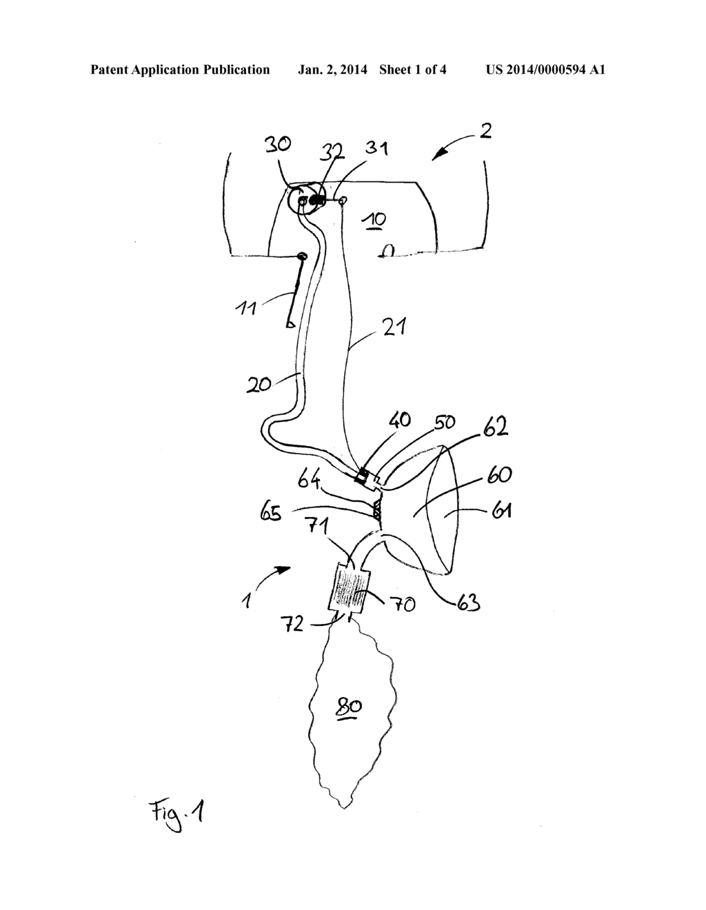 Aircraft passenger oxygen mask with closed circuit concept - diagram, schematic, and image 02