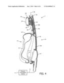 PATIENT INTERFACE DEVICE INCLUDING A MOVEABLE WEDGE FOREHEAD ADJUSTMENT     ASSEMBLY diagram and image