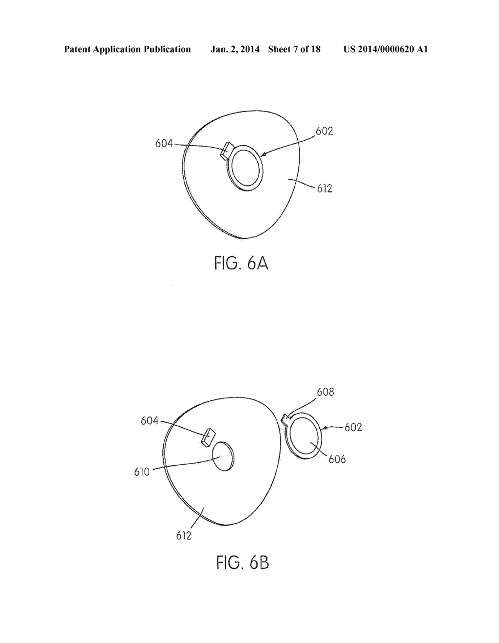 OXYGEN DIVERTER VALVE - diagram, schematic, and image 08