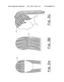 Hair Track for Use on a Wearer diagram and image