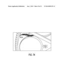 CUP SINGULATION AND DENESTING MECHANISM diagram and image