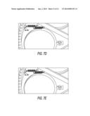 CUP SINGULATION AND DENESTING MECHANISM diagram and image