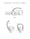 ANTI-SWAY ARRANGEMENT FOR CARGO ON A LOAD CARRIER diagram and image