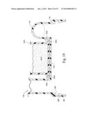 REMOVABLE AND/OR REPLACEABLE HUMIDIFIER diagram and image