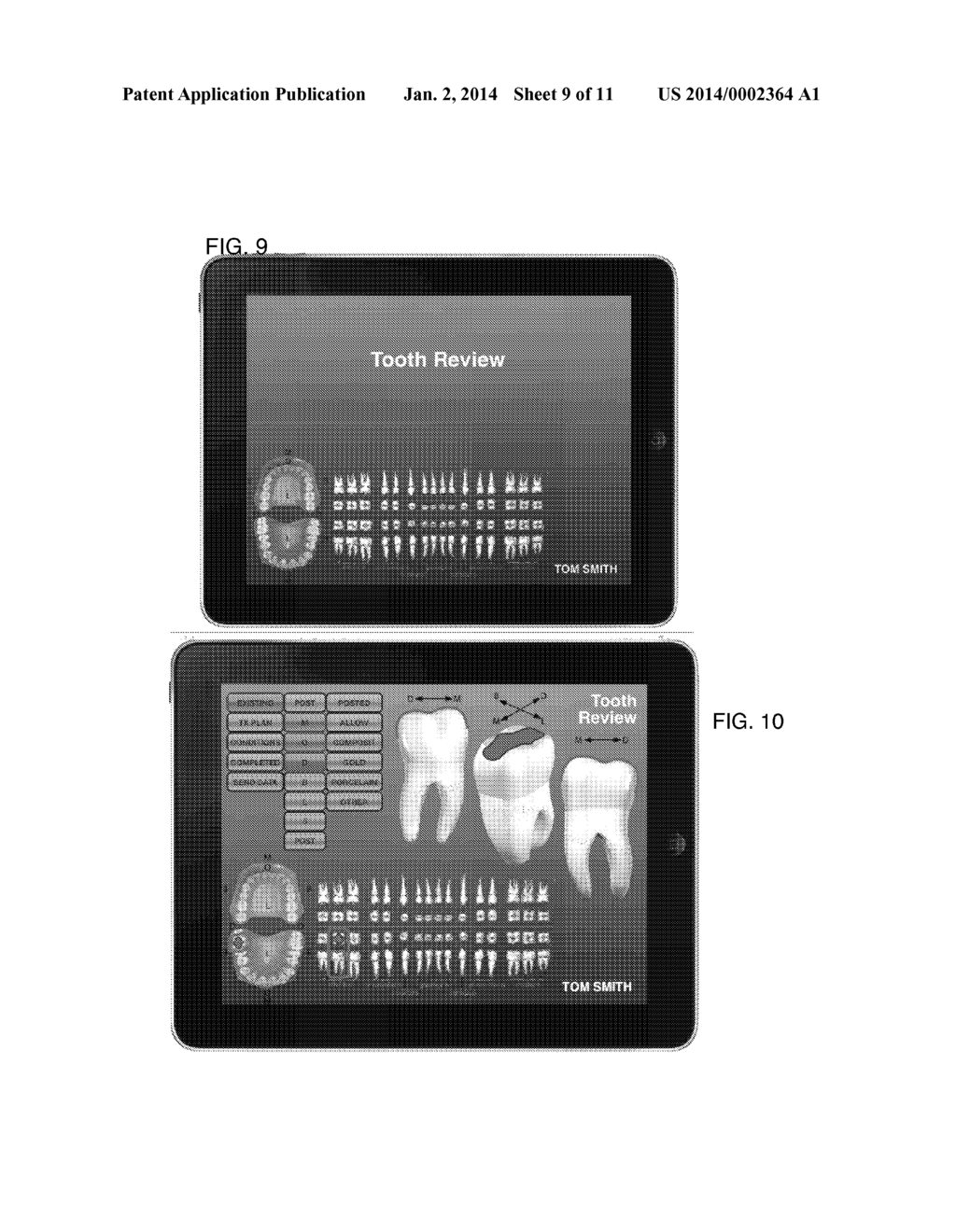 Specialized Keyboard for Dental Examinations - diagram, schematic, and image 10