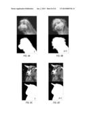 Temporal Matte Filter for Video Matting diagram and image