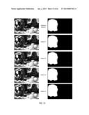 Temporal Matte Filter for Video Matting diagram and image