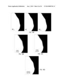 Temporal Matte Filter for Video Matting diagram and image