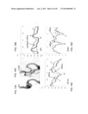 METHOD AND SYSTEM FOR EVALUATING HEMODYNAMICS OF A BLOOD VESSEL diagram and image