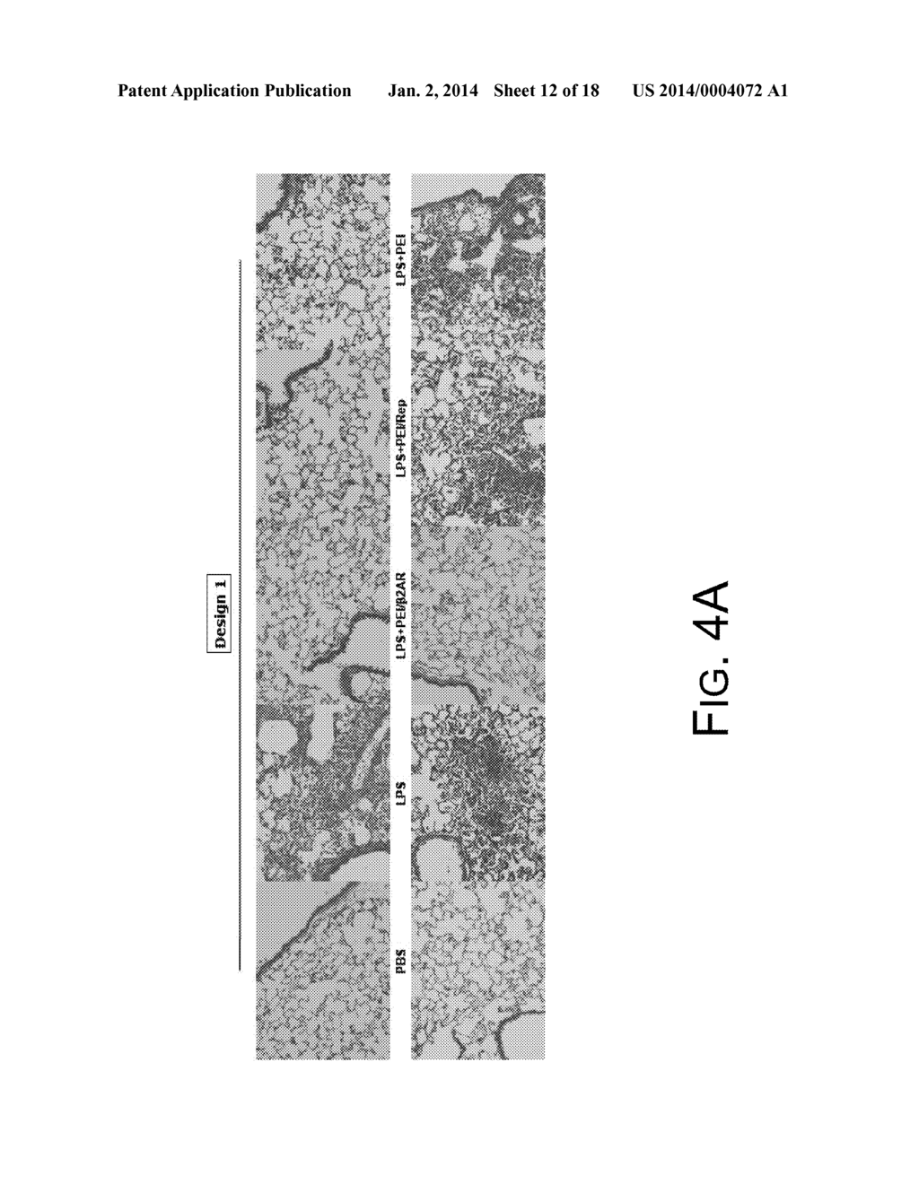 Polyethyleneimine And Beta2-Adrenergic Receptor Based Gene Therapy For     Acute Lung Injury - diagram, schematic, and image 13