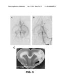 DODECAFLUOROPENTANE EMULSION AS A STROKE AND ISCHEMIA THERAPY diagram and image