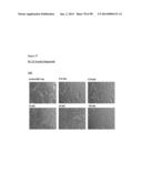 METHODS OF PREVENTING OR TREATING PAIN USING ANTI-NGF ANTIBODIES THAT     SELECTIVELY INHIBIT THE ASSOCIATION OF NGF WITH TRKA, WITHOUT AFFECTING     THE ASSOCIATION OF NGF WITH P75 diagram and image