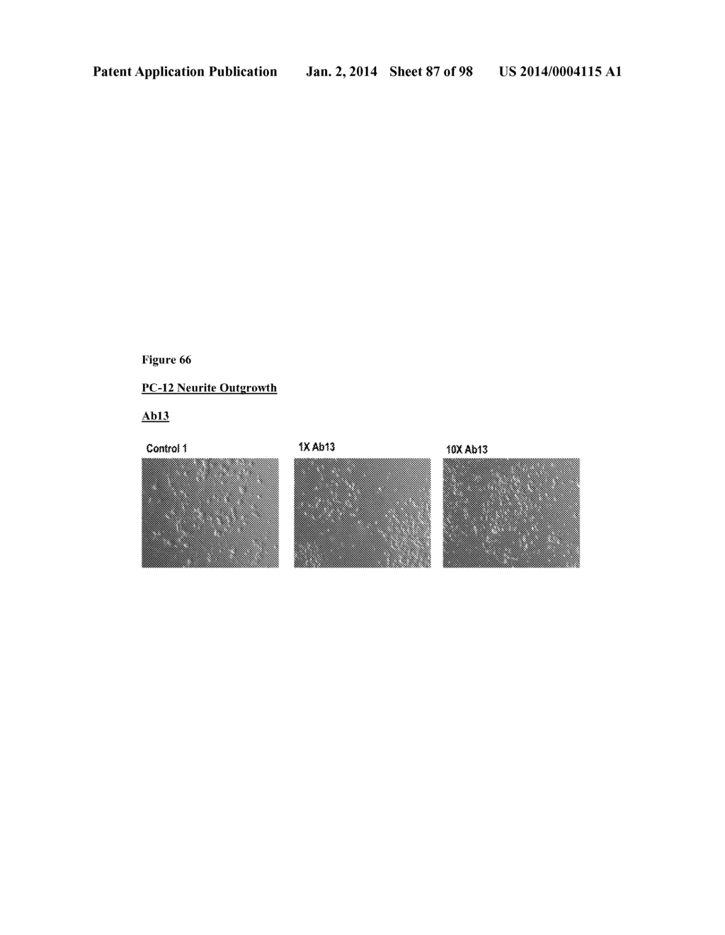 METHODS OF PREVENTING OR TREATING PAIN USING ANTI-NGF ANTIBODIES THAT     SELECTIVELY INHIBIT THE ASSOCIATION OF NGF WITH TRKA, WITHOUT AFFECTING     THE ASSOCIATION OF NGF WITH P75 - diagram, schematic, and image 88