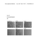 METHODS OF PREVENTING OR TREATING PAIN USING ANTI-NGF ANTIBODIES diagram and image