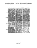 Methods and Compositions for Inhibiting Diseases of the Central Nervous     System diagram and image