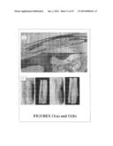 BONE SUBSTITUTE COMPOSITIONS, METHODS OF PREPARATION AND CLINICAL     APPLICATIONS diagram and image