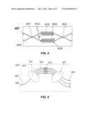 Method for Production of Optical Waveguides and Coupling and Devices Made     from the Same diagram and image