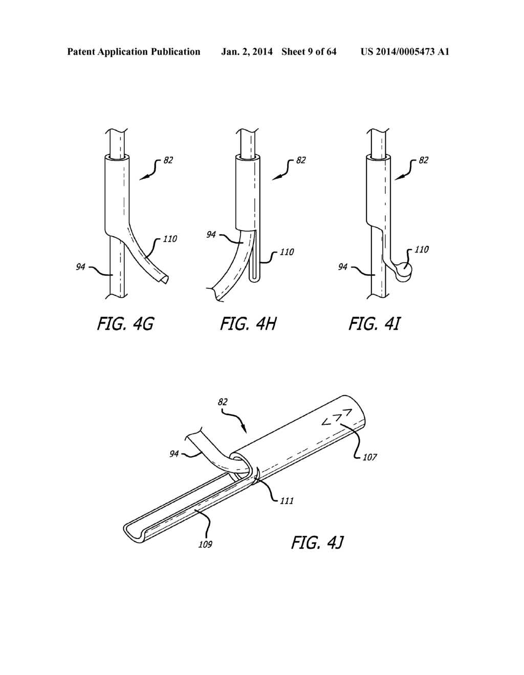 Integrated Handle Assembly for Anchor Delivery System - diagram, schematic, and image 10