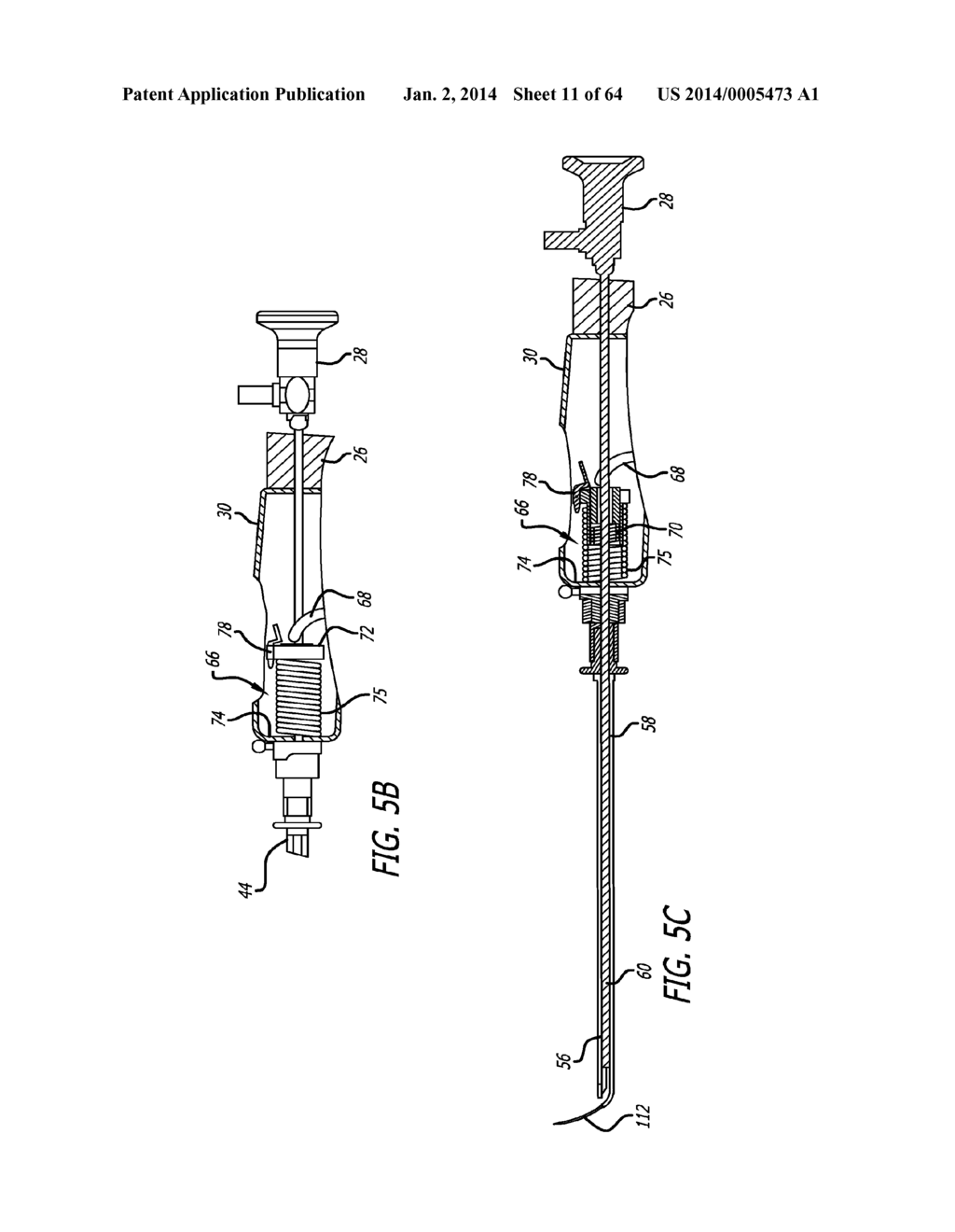 Integrated Handle Assembly for Anchor Delivery System - diagram, schematic, and image 12