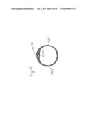 Vacuum System and Endoscopy Arrangement for Endoscopic Vacuum Therapy diagram and image