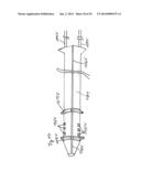 Vacuum System and Endoscopy Arrangement for Endoscopic Vacuum Therapy diagram and image