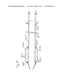 Vacuum System and Endoscopy Arrangement for Endoscopic Vacuum Therapy diagram and image