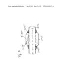 Vacuum System and Endoscopy Arrangement for Endoscopic Vacuum Therapy diagram and image