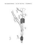 Vacuum System and Endoscopy Arrangement for Endoscopic Vacuum Therapy diagram and image