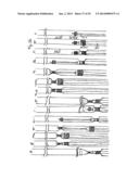 Vacuum System and Endoscopy Arrangement for Endoscopic Vacuum Therapy diagram and image