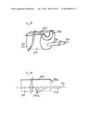 Vacuum System and Endoscopy Arrangement for Endoscopic Vacuum Therapy diagram and image