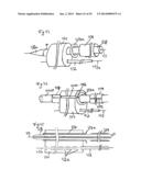 Vacuum System and Endoscopy Arrangement for Endoscopic Vacuum Therapy diagram and image