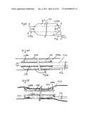 Vacuum System and Endoscopy Arrangement for Endoscopic Vacuum Therapy diagram and image