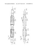 Vacuum System and Endoscopy Arrangement for Endoscopic Vacuum Therapy diagram and image