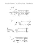 Vacuum System and Endoscopy Arrangement for Endoscopic Vacuum Therapy diagram and image