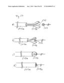 Vacuum System and Endoscopy Arrangement for Endoscopic Vacuum Therapy diagram and image