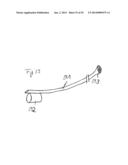 Vacuum System and Endoscopy Arrangement for Endoscopic Vacuum Therapy diagram and image