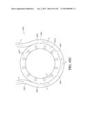 OPTICS FOR VIDEO CAMERAS ON A SURGICAL VISUALIZATION SYSTEM diagram and image