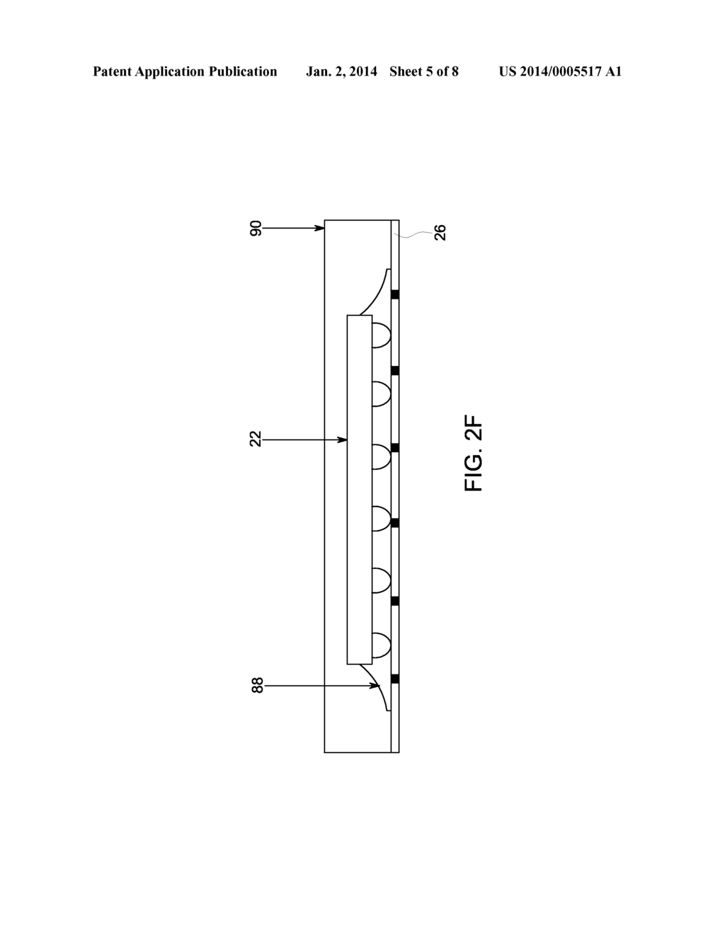 SENSOR ASSEMBLY FOR USE IN MEDICAL POSITION AND ORIENTATION TRACKING - diagram, schematic, and image 06