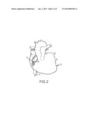 CARDIAC MAPPING SYSTEM AND METHOD diagram and image