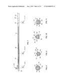 IVC FILTER CATHETER WITH IMAGING MODALITY diagram and image