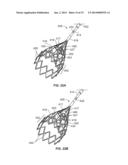 IVC FILTER CATHETER WITH IMAGING MODALITY diagram and image