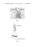ULTRASOUND IMAGING METHOD AND ULTRASOUND IMAGING APPARATUS diagram and image