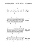 COATED MEDICAL DEVICE diagram and image