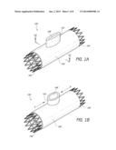 DEVICES, SYSTEMS, AND METHODS FOR REPAIR OF VASCULAR DEFECTS diagram and image